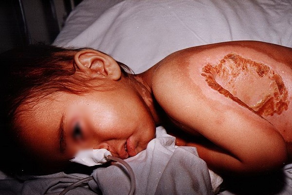 اقدام وحشیانه صدام در سردشت هزاران قربانی گرفت+ تصاویر